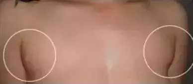 人體三處淋巴決定生死!學會淋巴按摩,隨時隨地救命!