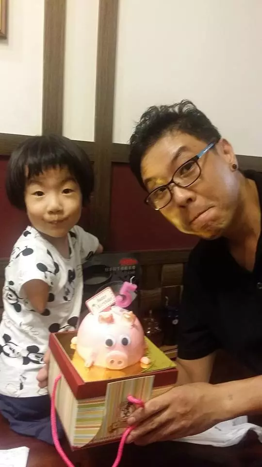 父賣米線照顧5歲身障女,她「天生只有一隻左腳」卻樂觀開朗:我的手腳不奇怪!