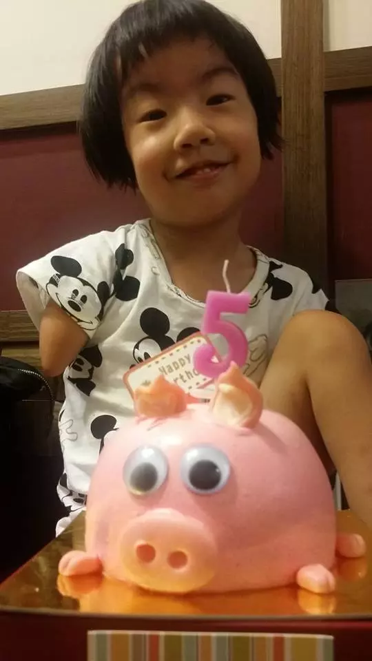 父賣米線照顧5歲身障女,她「天生只有一隻左腳」卻樂觀開朗:我的手腳不奇怪!