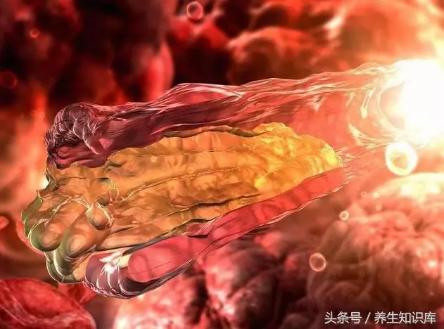 五個信號一出現,說明你的血液已「粘稠如粥」