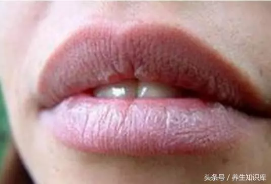 五個信號一出現,說明你的血液已「粘稠如粥」