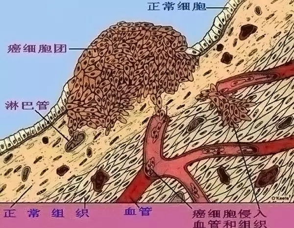 喂養癌細胞?專家:4類饅頭多吃一口癌近一步,別再買回家了!