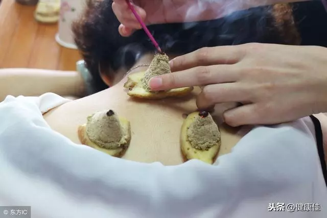 冬季養生:艾葉泡腳可防感冒