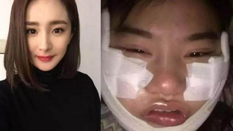 我想變楊冪!女粉450萬整成楊冪! 整容後全民跪
