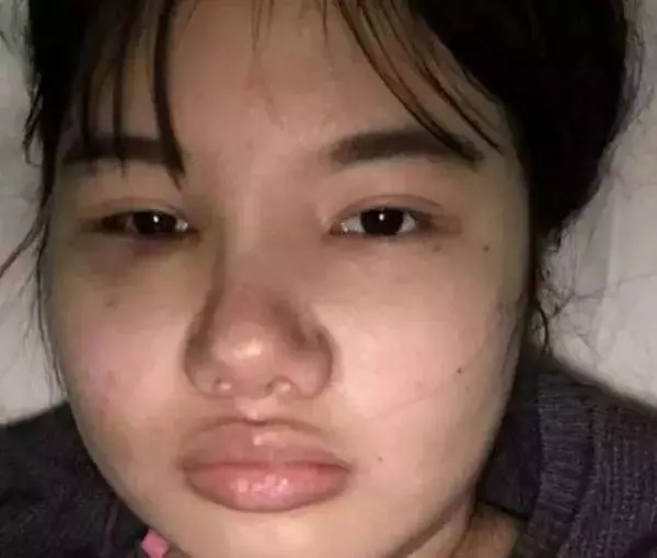 我想變楊冪!女粉450萬整成楊冪! 整容後全民跪
