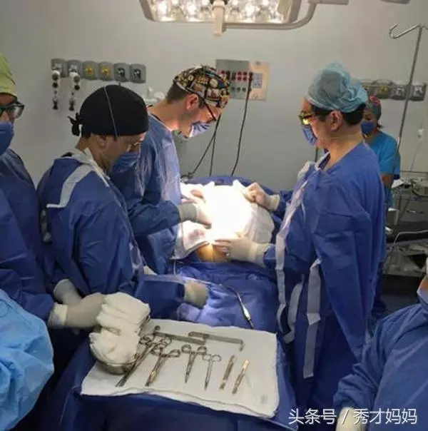 【爆趣】新婚人妻身懷32公斤「怪胎」?手術取出的東西嚇壞了所有醫生...