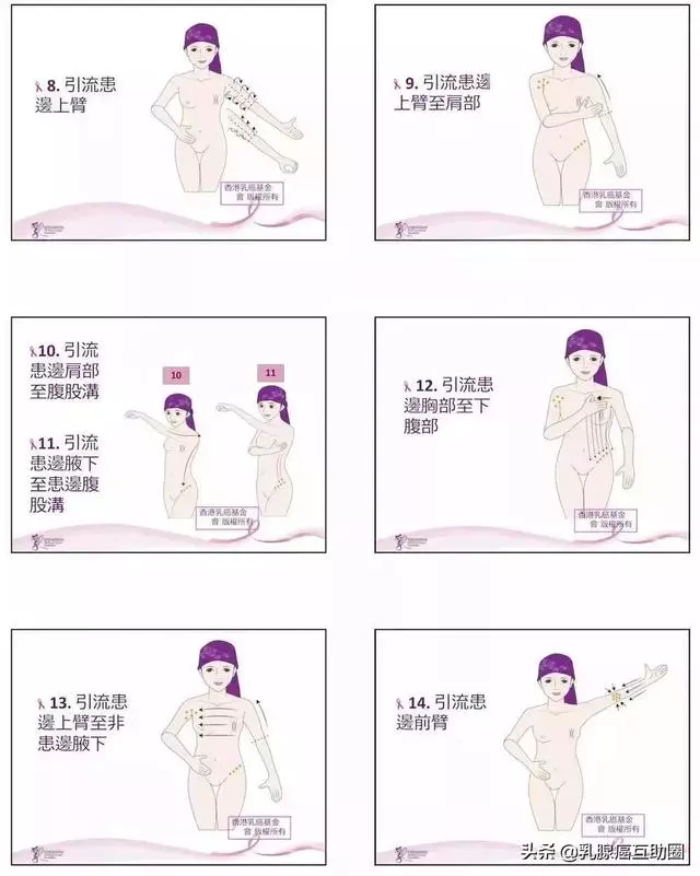 一圖看懂!如何避免乳腺癌術後淋巴水腫