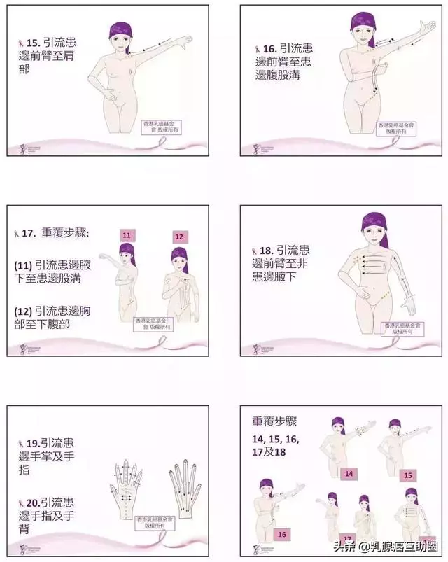 一圖看懂!如何避免乳腺癌術後淋巴水腫