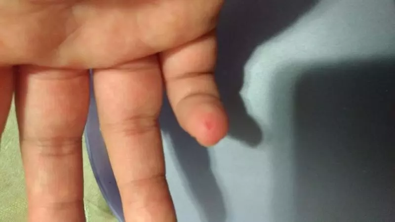睡到一半小指頭突然刺痛... 苦主驚醒看見「強先生」瞬間氣噗噗:我要誅你九族~