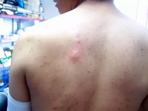 睡到一半小指頭突然刺痛... 苦主驚醒看見「強先生」瞬間氣噗噗:我要誅你九族~