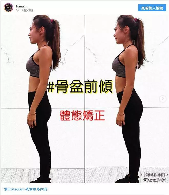 無法彎下腰可能是歪骨盆! 1天5分鐘「拉筋矯正」兩週自然瘦下4kg