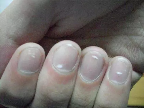 醫生:如果你睡覺時沒有這3種情況,說明你的肝臟非常健康分享出去可能會幫助更多人