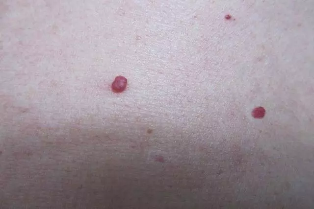 醫生:如果你睡覺時沒有這3種情況,說明你的肝臟非常健康分享出去可能會幫助更多人
