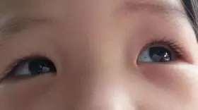 眼白出現這幾種顏色 你該警惕了幫家人也看一看