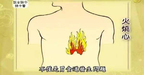 常常胃食道逆流嗎? 只要多吃這幾種食物 就不用買胃藥了!