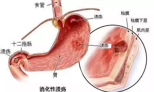身體發出了的7個信號,告訴你體內垃圾已超標,快來自己診斷下