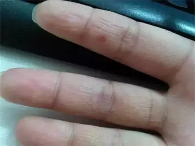 身體發出了的7個信號,告訴你體內垃圾已超標,快來自己診斷下