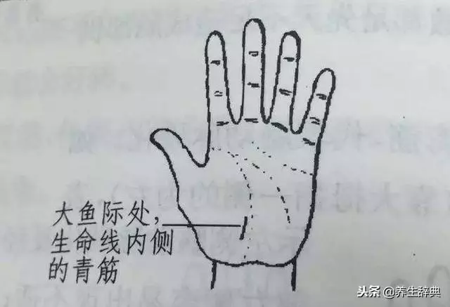 手上這些部位出現青筋,是身體向你敲警鐘,再不注意就晚了!