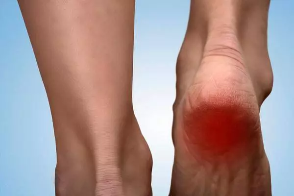 早上起床,腳一踩地就疼到不行,到底怎麼了?專家為你解惑