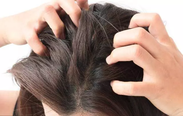 4種信號是頭蟎發出的「健康警告」,別等頭蟎占滿整個頭才知道