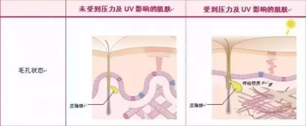 「7天」改善毛孔粗大問大!不改善你會老得更快!