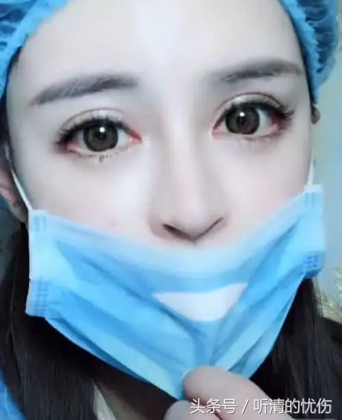 女孩自爆「整形失敗沒人要」,拉下口罩的一瞬間...網友:就算失敗我也娶!