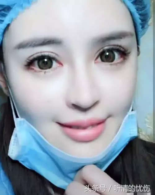 女孩自爆「整形失敗沒人要」,拉下口罩的一瞬間...網友:就算失敗我也娶!