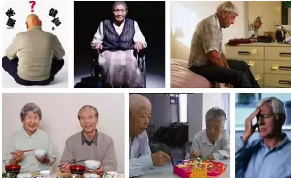 什麼是老年癡呆症?它真的很可怕!但預防原來這麼簡單!