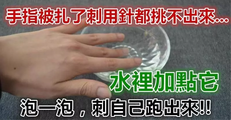 「手指被扎了刺」用針都挑不出來?水裡加點「它」泡一泡,讓刺自己跑出來......
