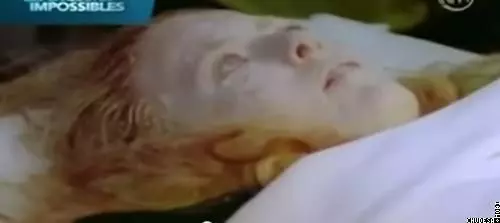 -22度的戶外躺6小時!少女被「瞬間冷凍」送醫 正準備宣讀時她卻突然發出聲音…