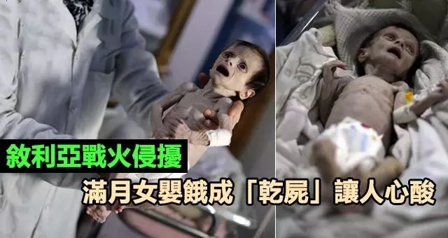 滿月女嬰餓成「乾屍」體重只有1900克 張大嘴卻哭不出聲 讓人心酸