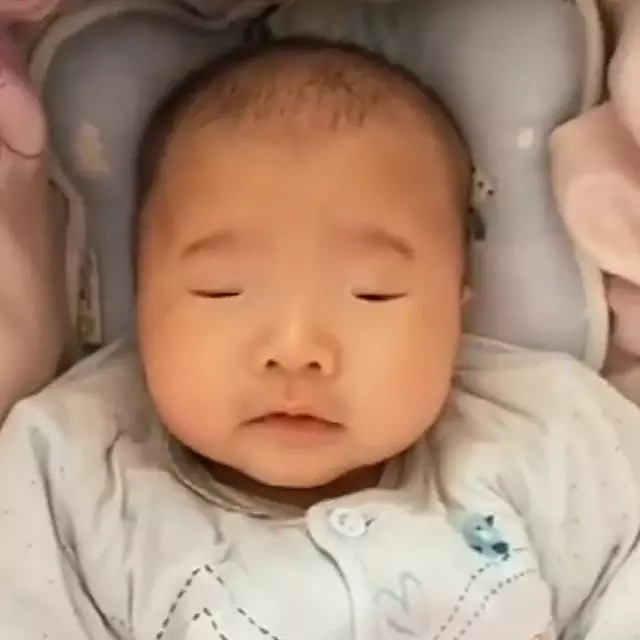 三個月寶寶眼睛很小,媽媽分不清眼睛是否睜開,醫生一句話揭開謎團