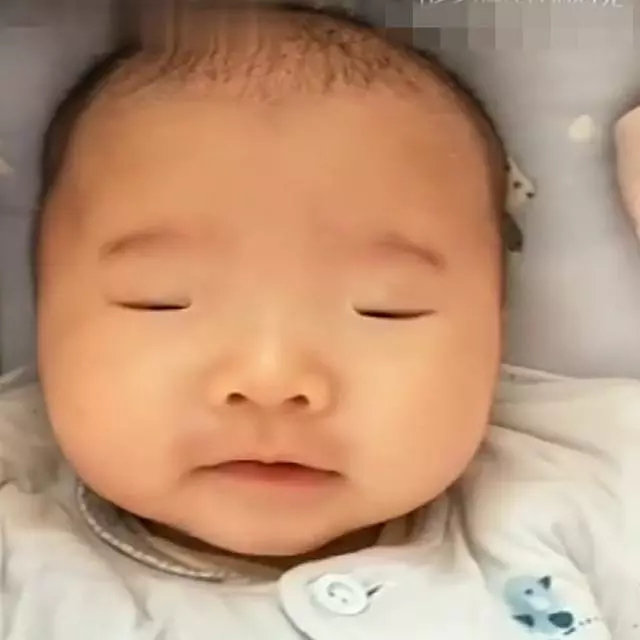 三個月寶寶眼睛很小,媽媽分不清眼睛是否睜開,醫生一句話揭開謎團