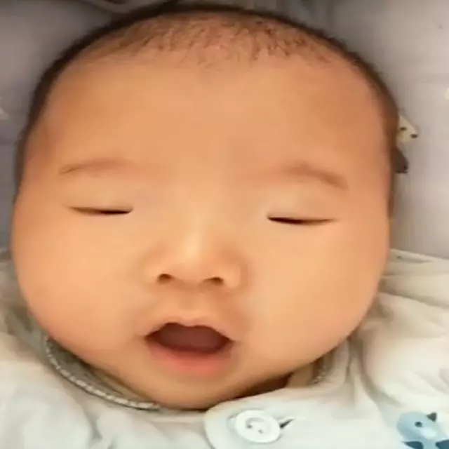 三個月寶寶眼睛很小,媽媽分不清眼睛是否睜開,醫生一句話揭開謎團