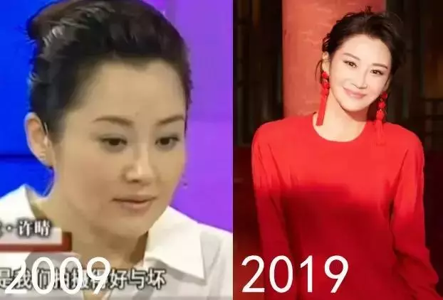 明星10年顏值變化,對不起,看到錢楓我忍不住笑了
