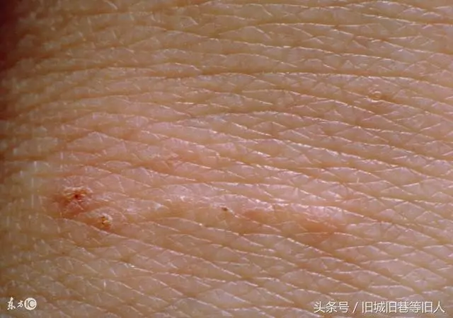 曬完被子有「太陽的味道」?專家告訴你崩潰事實,那味道來自蟎蟲,太噁心了