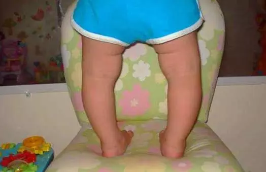 2歲兒子走路成「O」型腿,送醫檢查後一家人痛哭,媽媽罵阿公阿嬤:太自私