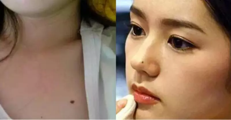命理解析!女人不想婚姻不幸,財運不濟,一定要去掉這9顆「黴運痣」!!