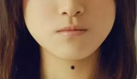命理解析!女人不想婚姻不幸,財運不濟,一定要去掉這9顆「黴運痣」!!