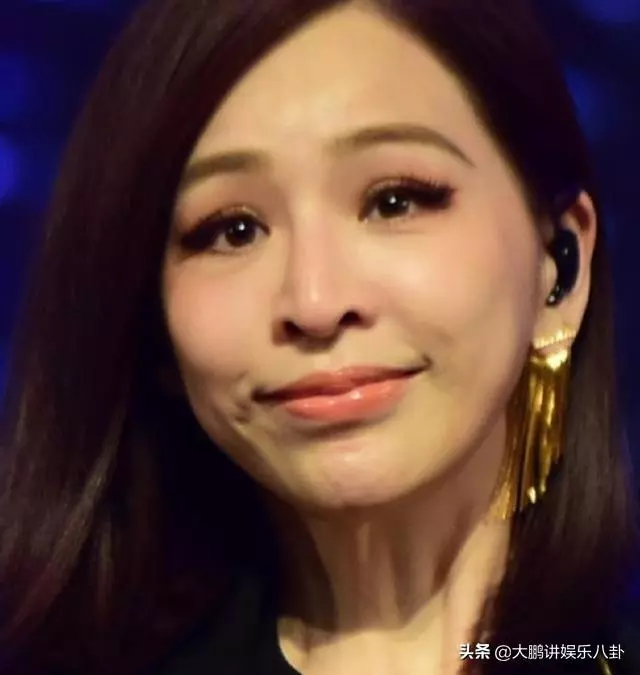 這些被「玻尿酸」毀掉的女星,看完你還敢打嗎?