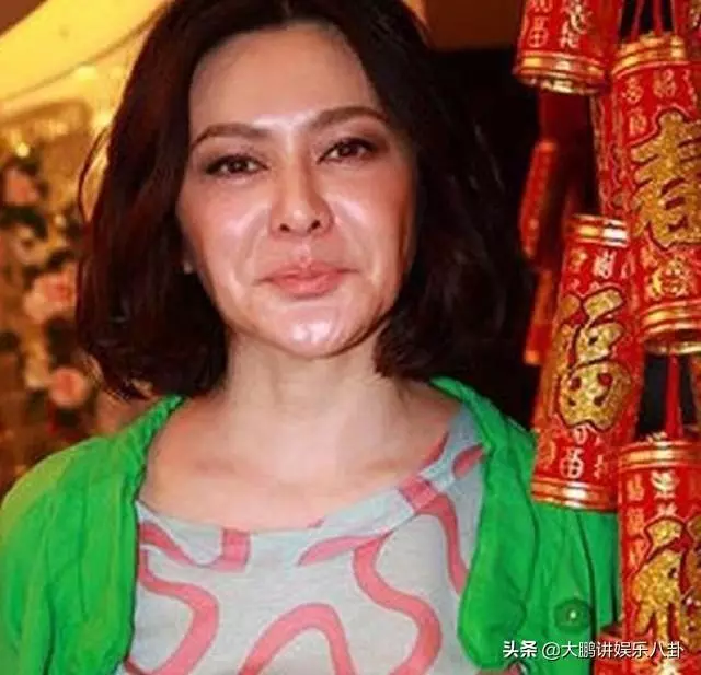這些被「玻尿酸」毀掉的女星,看完你還敢打嗎?