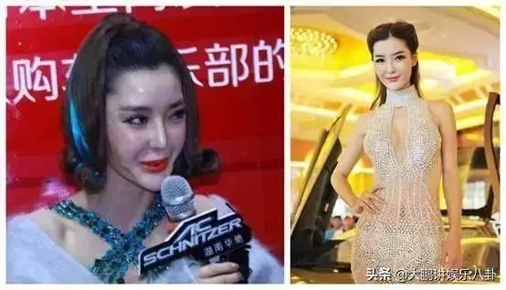 這些被「玻尿酸」毀掉的女星,看完你還敢打嗎?
