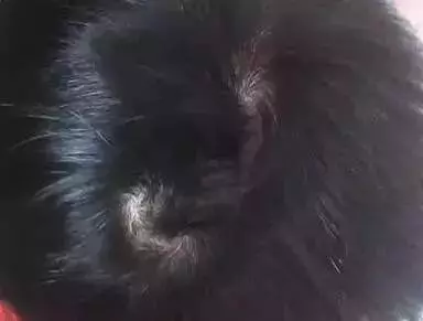 頭上有幾個漩,就代表你是什麼命!有三個漩的人註定不一般,太準了