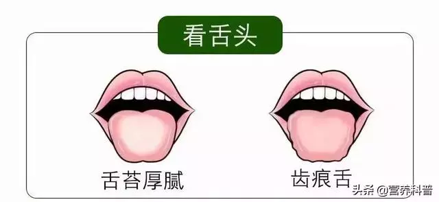 5個實用小方法,自測濕氣有多重!教你3招,健脾化濕,排出濕氣