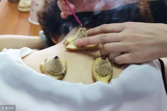 抑鬱消沉、唉聲嘆氣、失眠多夢,艾灸此穴,讓你神采氣揚!