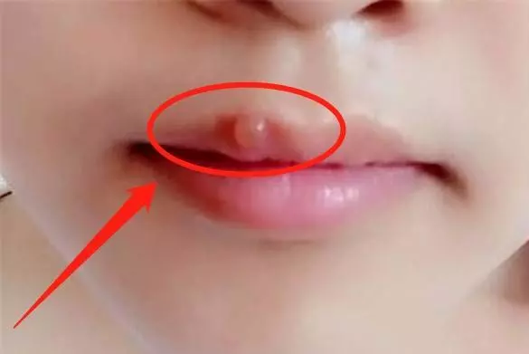 肝臟毒素增多,臉上可能有4種變化?若1個都不佔,肝也還不錯