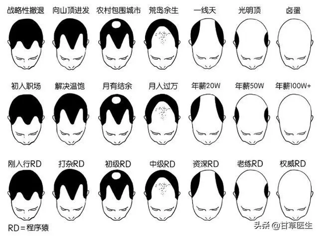 中醫談脫髮|拿什麼拯救你,我的髮際線!