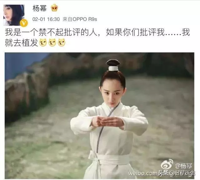 中醫談脫髮|拿什麼拯救你,我的髮際線!