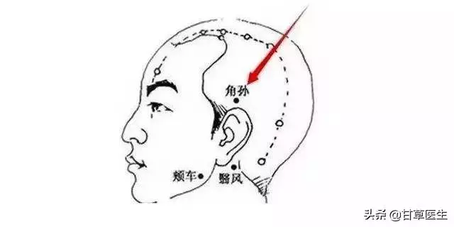 中醫談脫髮|拿什麼拯救你,我的髮際線!