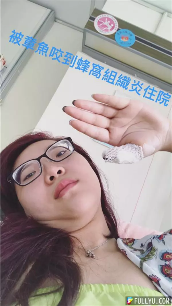 台灣網絡紅人宛宛兒竟嘗試讓章魚吸自己的...,結果章魚一吸,居然變成這樣,悲劇了!...